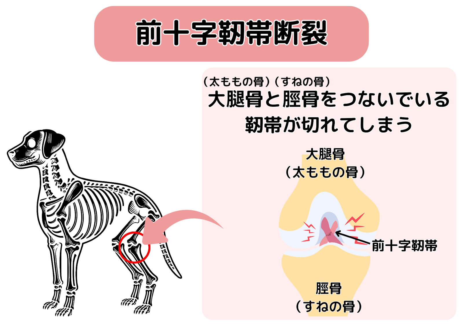 犬の前十字靭帯断裂を説明する図。大腿骨と脛骨をつなぐ前十字靭帯が断裂している様子をイラストで示している。