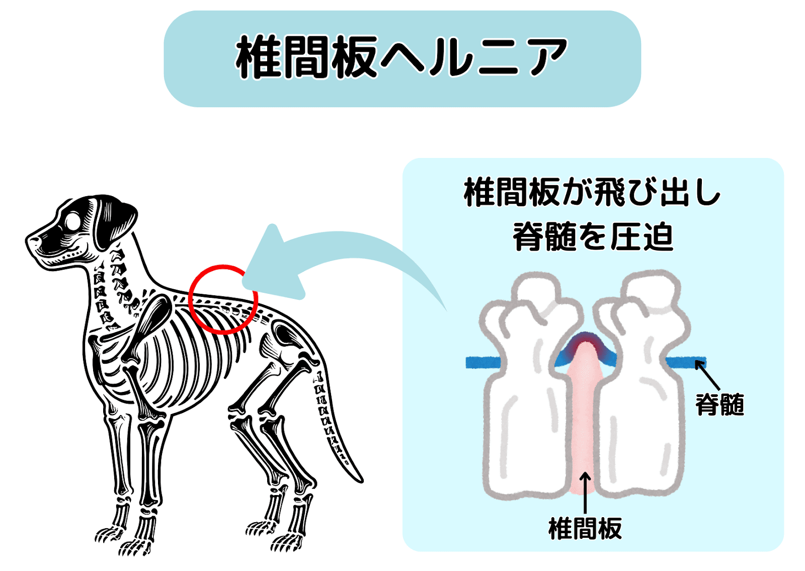 犬の椎間板ヘルニアを説明する図。背骨の一部で椎間板が飛び出し、脊髄を圧迫している様子が示されている。